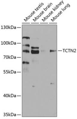 Western Blot: TCTN2 Antibody [NBP2-94043] - Western blot analysis of extracts of various cell lines, using TCTN2 antibody (NBP2-94043) at 1:1000 dilution. Secondary antibody: HRP Goat Anti-Rabbit IgG (H+L) at 1:10000 dilution. Lysates/proteins: 25ug per lane. Blocking buffer: 3% nonfat dry milk in TBST. Detection: ECL Basic Kit. Exposure time: 90s.